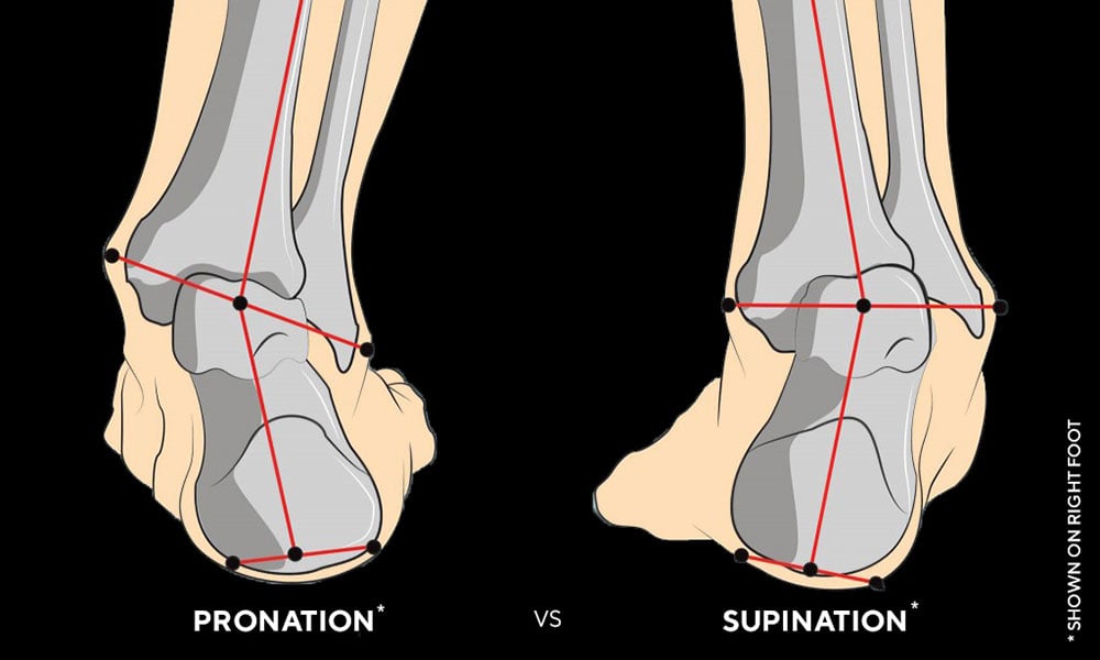 Pronationvssupination-1000x600.jpg